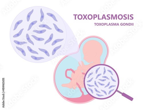 Toxoplasmosis cyst Fecal life cycle cat retina eye hiv aids mother child retina pet women animal faece poop fetal birth defect T. gondii poo meat pork virus fungi