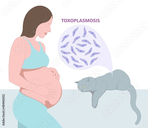 Toxoplasmosis cyst Fecal life cycle cat retina eye hiv aids mother child retina pet women animal faece poop fetal birth defect T. gondii poo meat pork virus fungi