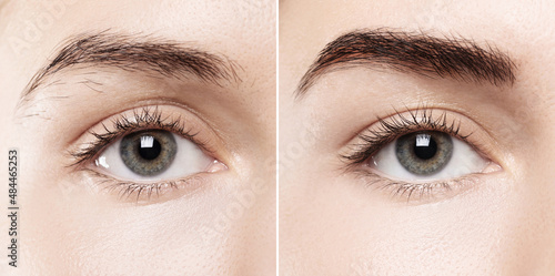 Canvas Print Comparison of female brow after eyebrow shape correction