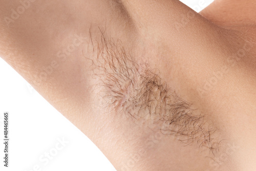 Papier peint Closeup of hairy female armpit