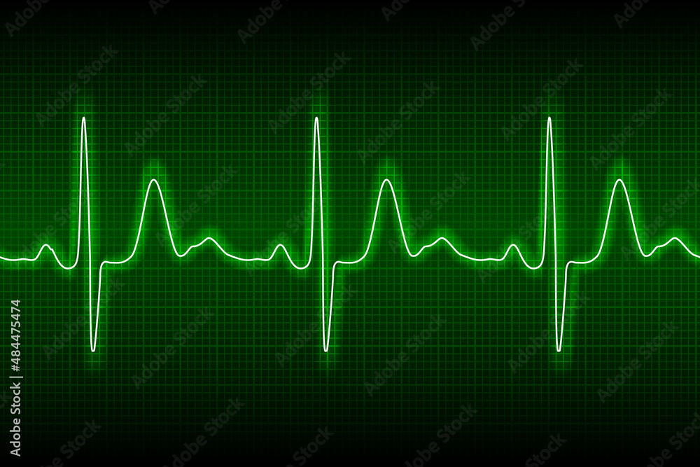 Heart beat ecg or ekg seamless neon line on green background. Electrocardiogram graph of healsh cardio rate. Examination of human health. Medicine test cardiac rhythm and pulsating inteval.