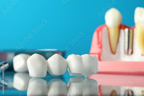 Dental bridge near educational model of gum with implant on light blue background, closeup photo
