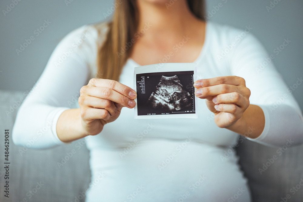 Happy young pregnant woman holding an ultrasound scan image. Smiling beautiful mother with ultrasound of her unborn baby. Pregnancy concept, maternity prenatal care.