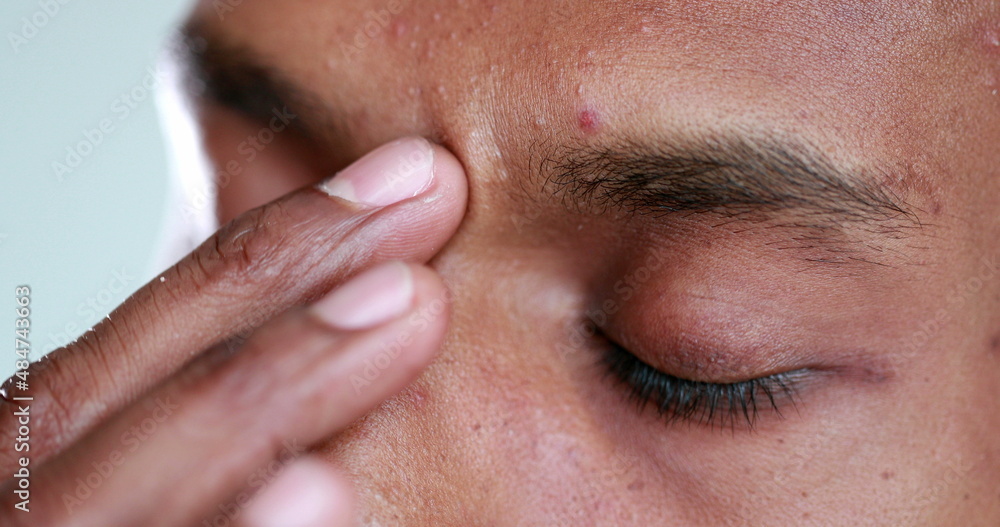 Tired man rubbbing eye with hand. Exhausted african american touching face Tired man rubbbing eye with hand. Exhausted african american touching face
