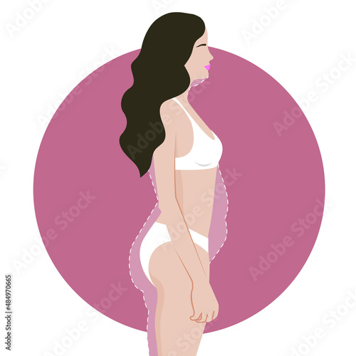 Woman body fat reduction and liposuction