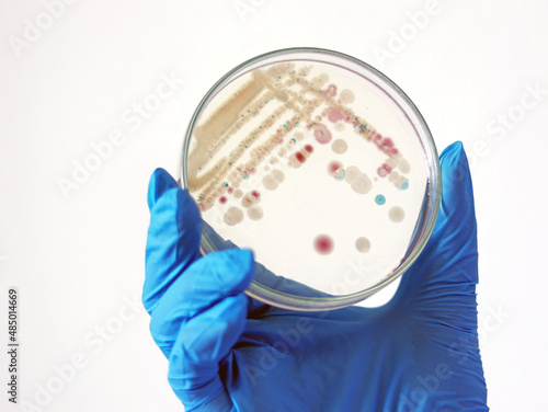 Researcher is holding Petri dish of Vibrio vulnificus in CHROMagar and TCBS, an estuarine bacterium which occurs in in filter-feeding molluscan shellfish, such as oysters., ingestion of the bacterium.