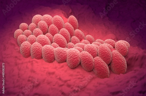 Fotografie Endometrial cancer cells (adenocarcinoma) in the uterus or cervix (womb neck) -