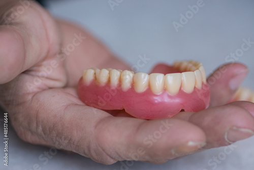 Close-up in the hand of an elderly man a removable prosthesis, false teeth. Dental prosthetics services. Dental implantation concept. selective focus