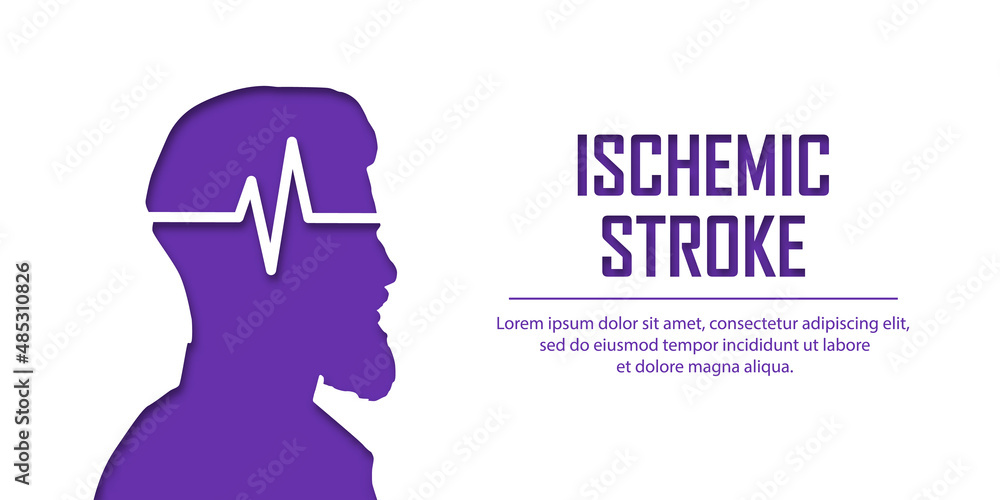 People suffering from ischemic stroke. Ischemic stroke patient concept. Medical help. People silhouette in paper cut style. Stroke types poster, banner. Medical vector illustration