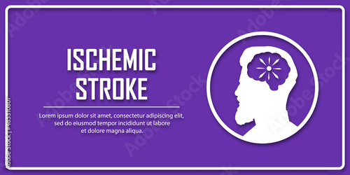 People suffering from ischemic stroke. Ischemic stroke patient concept. Medical help. People silhouette in paper cut style. Stroke types poster, banner. Medical vector illustration