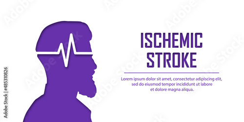 People suffering from ischemic stroke. Ischemic stroke patient concept. Medical help. People silhouette in paper cut style. Stroke types poster, banner. Medical vector illustration