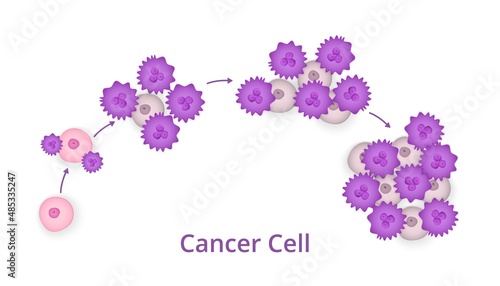Process of development of cancer cells. Scheme of progression of carcinoma with numerous divisions onco cells that muffle vector healthy ones. photo