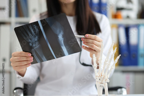Doctor traumatologist examines x-ray with arm injury closeup photo