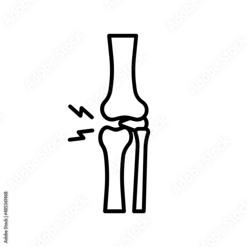 knee arthrosis
