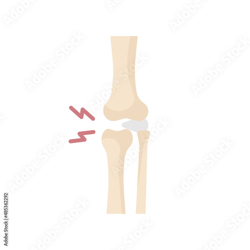 knee arthrosis