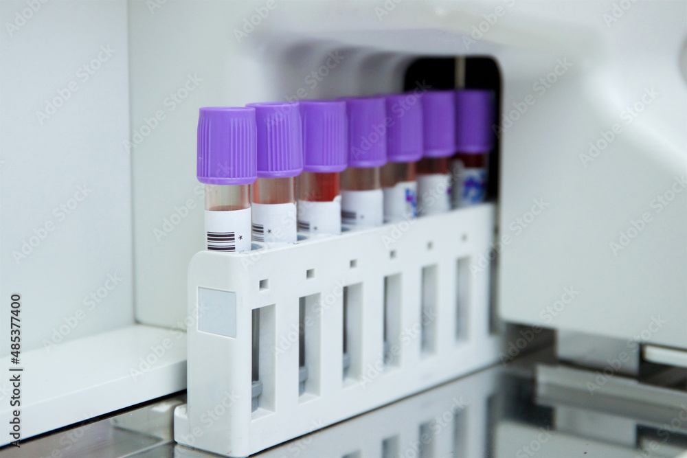Test tubes for biomaterials in the analyzer Test tubes for biomaterials in the analyzer
