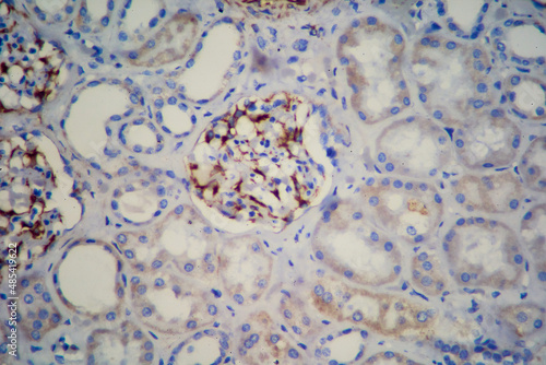 Immunohistochemistry Endothelial cells and glomerulus, kidney sample.