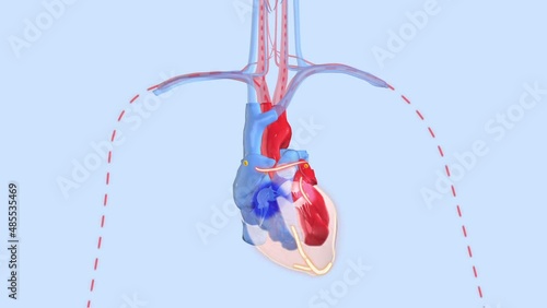 Arrhythmia: Irregular heartbeat and atrial fibrillation of a human heart, 3d animation photo