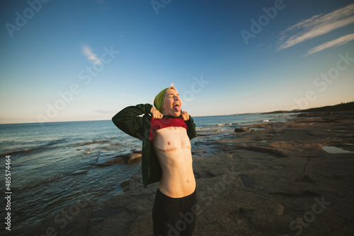 Transgender man standing on coast and showing breast removal scars photo