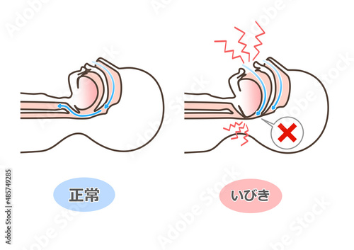 いびきの図解イラスト