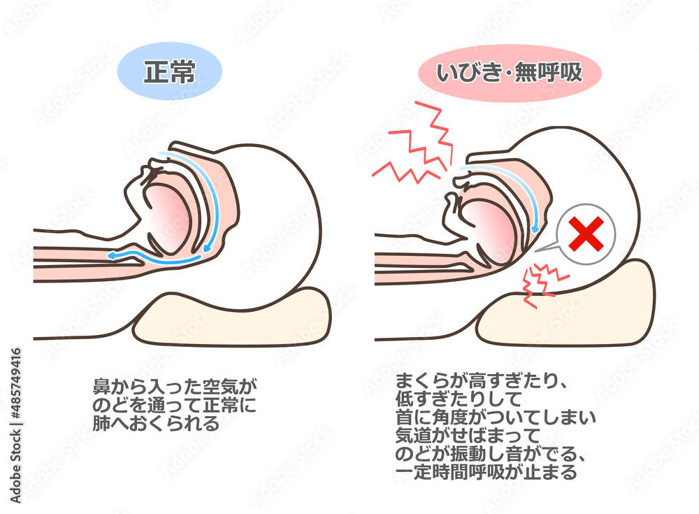 いびきの図解イラスト Stock Illustration Adobe Stock