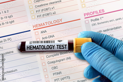 Blood tube test with requisition report for Hematology test. Blood sample tube for analysis of Hematology in laboratory. photo