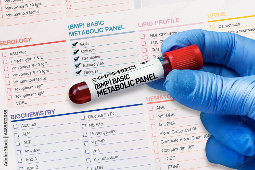 Blood Tube Test With Requisition Form For BMP Basic Metabolic Panel Testing Blood Sample Tube