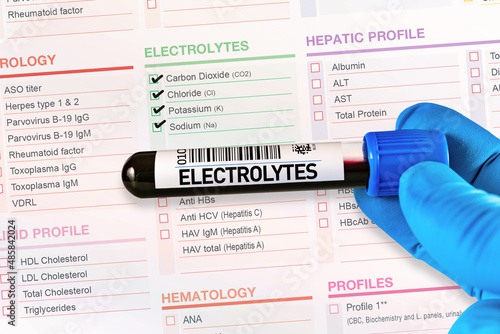 Blood tube test with requisition form for Electrolyte test. Blood sample tube for analysis of Electrolytes profilings in laboratory photo