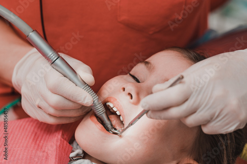 Treatment of baby teeth in a child, a little girl at the dentist, examination and treatment of teeth.