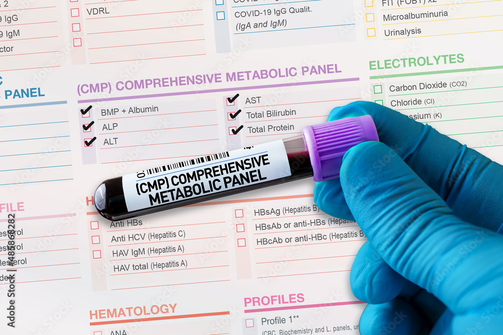 Blood Tube Test With Requisition Form For CMP Comprehensive Metabolic 