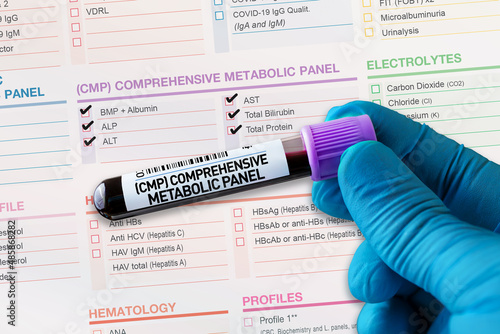 Blood tube test with requisition form for CMP Comprehensive Metabolic Panel testing. Blood sample tube for analysis of CMP Comprehensive Metabolic Panel in laboratory photo