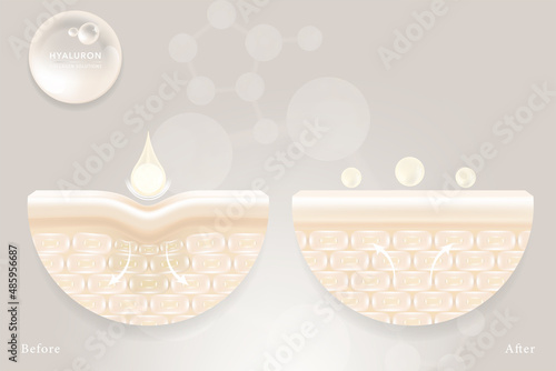 Hyaluronic acid before and after skin solutions ad, white collagen serum drops with cosmetic advertising background ready to use, illustration vector.	