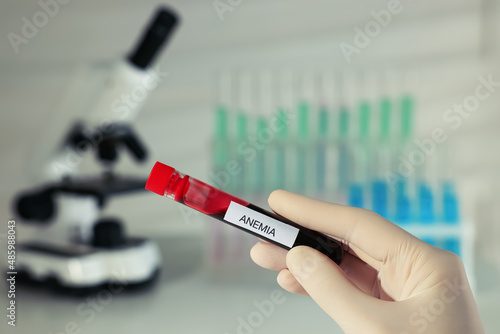 Scientist holding test tube with blood sample and label Anemia on blurred background, closeup photo