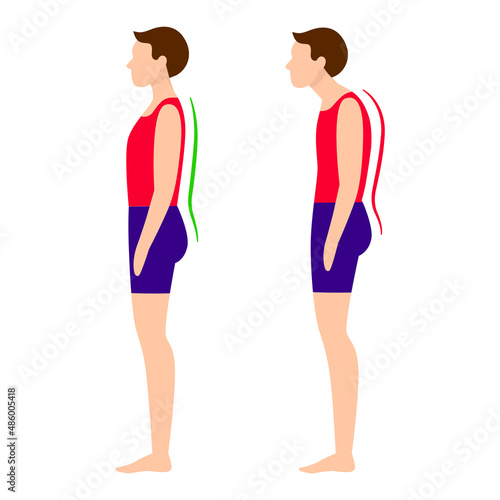 Young man, correct and incorrect posture, spine
