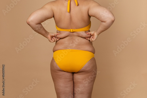Cropped image of overweight fat woman back with obesity, excess fat in yellow swimsuit. Big size. Holding waist flabs, visceral, cellulite. Varicose veins, imperfection skin puffy body. Liposuction photo