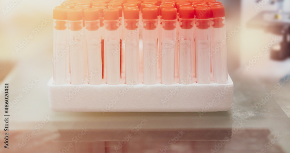 dropper in tube research in laboratory for chemistry research in medicine and biotechnology dropper in tube research in laboratory for chemistry research in medicine and biotechnology
