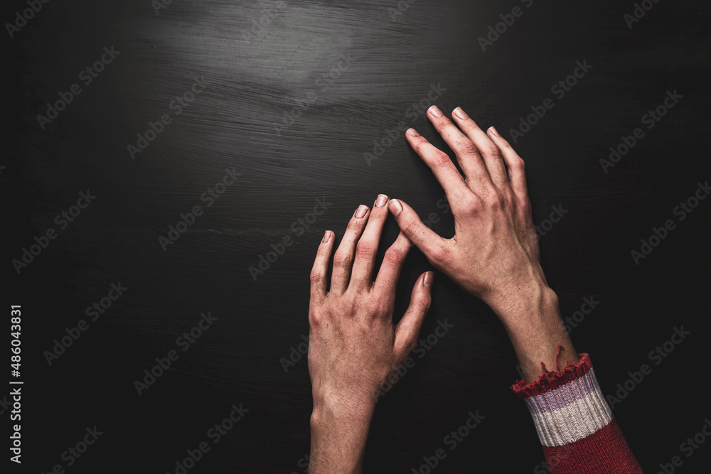 Ταπετσαρία Poverty and hunger - dirty skinny child’s hands on black background, copy space