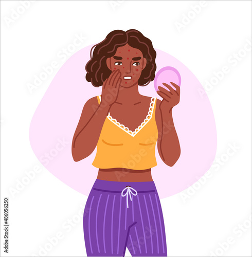 Acne, spotty skin. Black woman looking in round mirror. Skincare, skin problems, pimples concept. Symptom of pms. Hand drawn cartoon character. Vector flat isolated illustration.