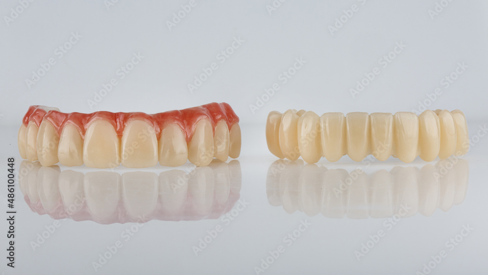 dental prostheses of the upper and lower jaw on a white background with reflection dental prostheses of the upper and lower jaw on a white background with reflection