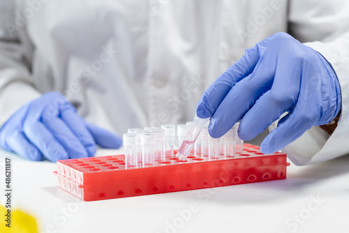 Medical personnel take sample tube with transparent liquid from box tray