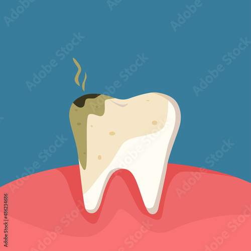 Dental cavity concept.Dental problem. Toothache and bad breath. Oral care