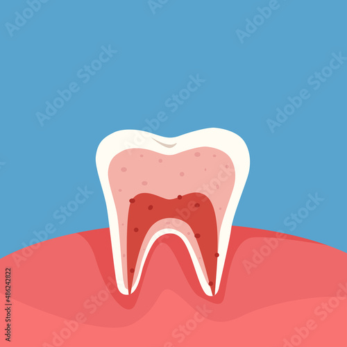 Diagram of a cross section of a tooth showing the layers of enamel, dentin, pulp with blood vessels and nerves. Dental anatomy concept. Vector cartoon illustration
