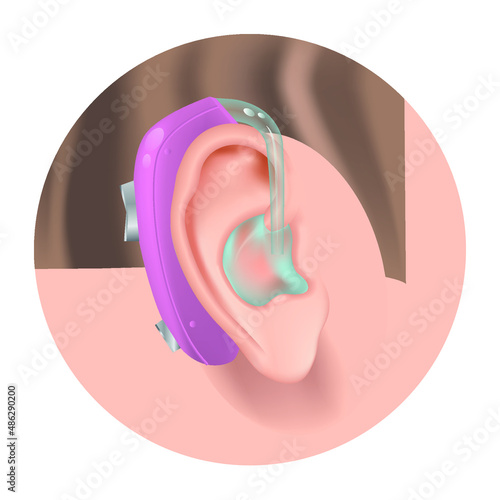Hearing aid. Fighting deafness. Sound amplifier. The structure of the outer ear. Vector illustration