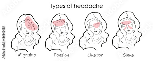 Types of headache illustrated on a woman face, design template for medicine or therapy for headache.Vector abstract minimal illustration in line art style. 