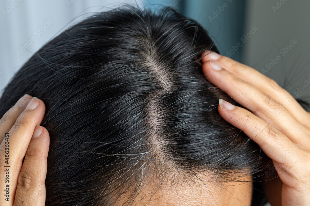 Obraz premium Closeup young asian woman head with natural dark hair root turn gray too early. The hair turn white early because of stress.