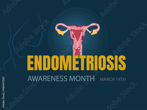 Vectorial illustration of endometriosis awareness.14 March.Female reproductive system with signs of endometriosis on blue background and silhouette of woman.Space for copy space