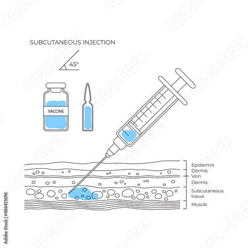 Types of injections. Guide to injecting vaccines into skin. Vector medical procedure manuals for hospital workers
