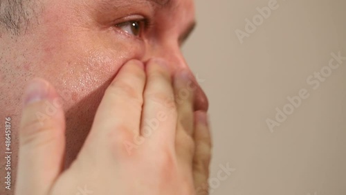 Wallpaper Mural a young european man smears moisturizer on the skin around his eyes. close-up macro shot Torontodigital.ca