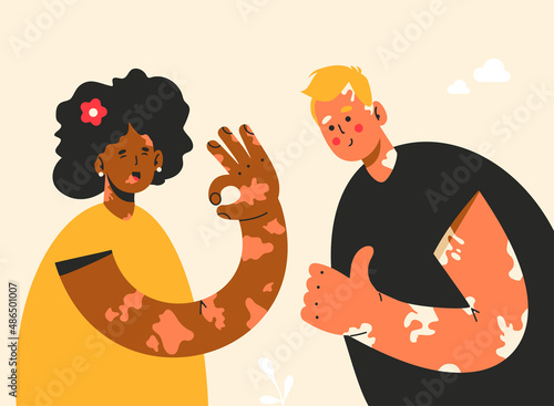Vitiligo. Skin disorder. African woman and caucasian man gesturing ok and fine. Loss of melanin. Diversity, body positive, self acceptance concept. Love greeting card. World vitiligo day. photo