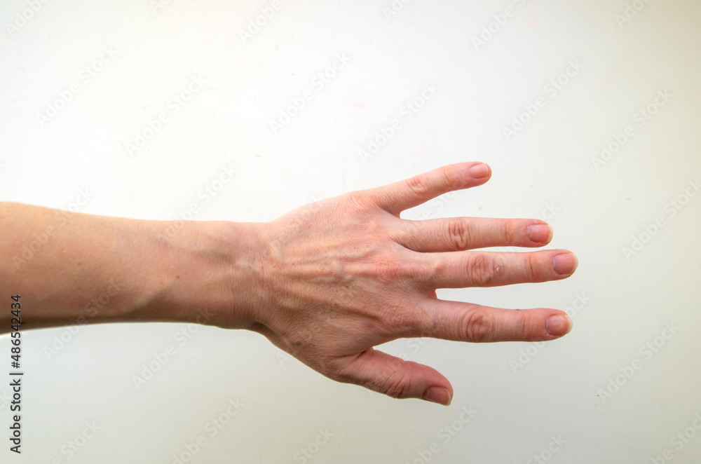 Hand with chapped skin and age-related changes
